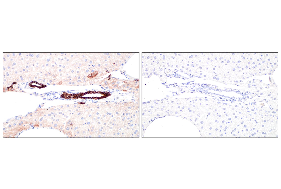 Immunohistochemistry Image 13: Pan-Keratin (Type I) (E6S1S) Rabbit Monoclonal Antibody