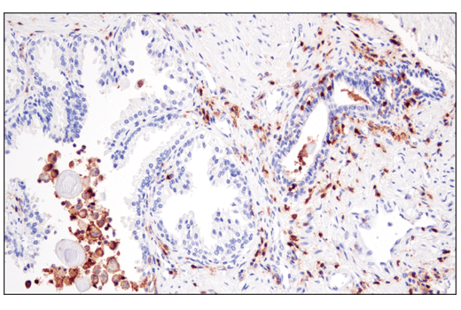 Immunohistochemistry Image 7: CD48 (D7L8I) Rabbit Monoclonal Antibody (BSA and Azide Free)