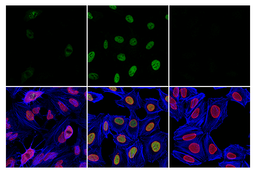 Immunofluorescence Image 1: Phospho-ATF-2 (Thr69)/ATF-7 (Thr51) (E3D6B) Rabbit Monoclonal Antibody
