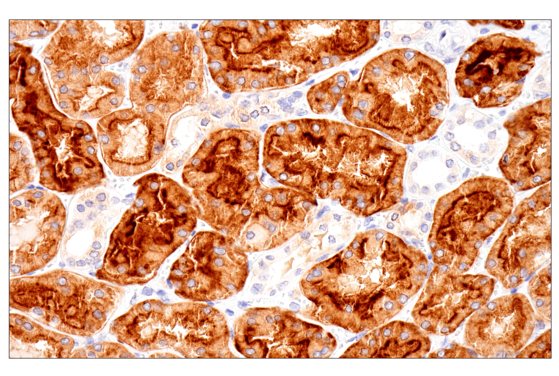 Immunohistochemistry Image 3: Folate Receptor Alpha/FOLR1 (BN3.2) Mouse Monoclonal Antibody