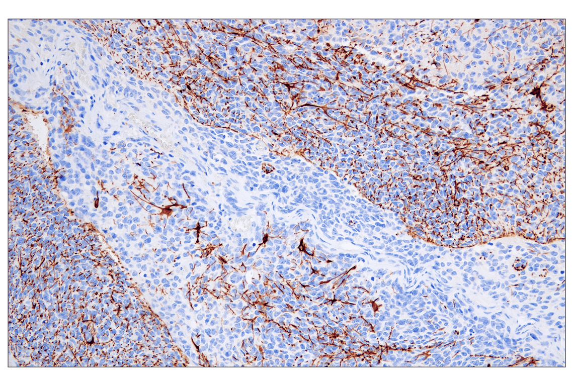 Immunohistochemistry Image 3: GFAP (E4L7M) XP<sup>®</sup> Rabbit mAb (BSA and Azide Free)