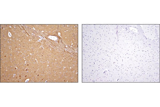 Immunohistochemistry Image 2: NDRG4 (D4A6) Rabbit Monoclonal Antibody