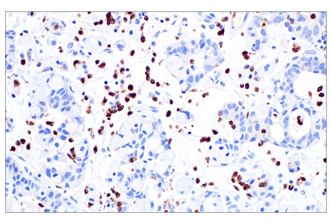 Immunohistochemistry Image 1: CD89/FCAR (F1T9J) Rabbit Monoclonal Antibody
