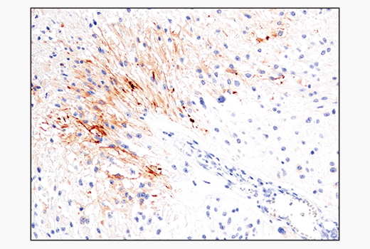 Immunohistochemistry Image 3: IL-13RA2/CD213a2 (E7U7B) Rabbit Monoclonal Antibody