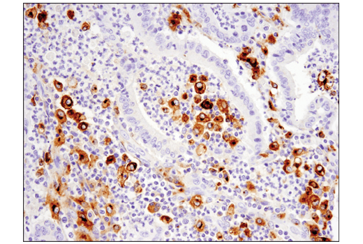 Immunohistochemistry Image 1: GPNMB (E4D7P) Rabbit Monoclonal Antibody