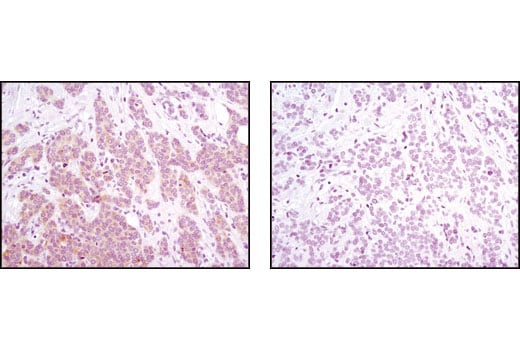 Immunohistochemistry Image 1: Phospho-PRAS40 (Thr246) (C77D7) Rabbit Monoclonal Antibody (BSA and Azide Free)