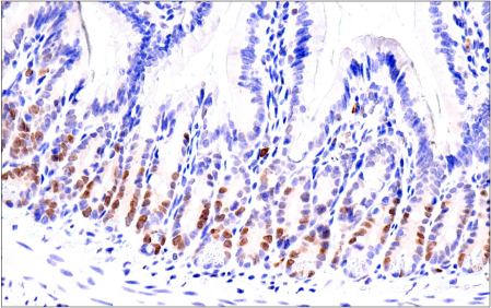 Immunohistochemistry Image 6: ATAD2 (E8Y7F) Rabbit Monoclonal Antibody
