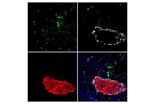 Immunofluorescence Image 3: TIPE2 (E5Q2S) Rabbit Monoclonal Antibody