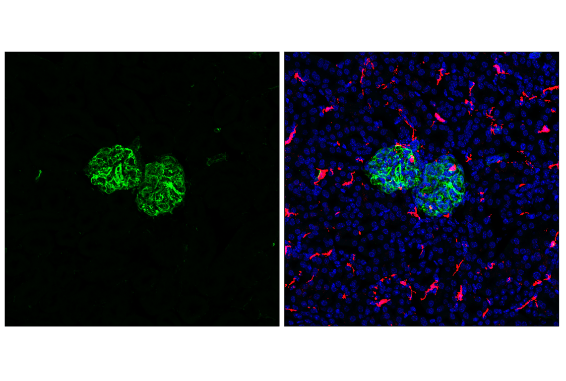 Immunofluorescence Image 1: Vimentin (D21H3) Rabbit Monoclonal Antibody (BSA and Azide Free)