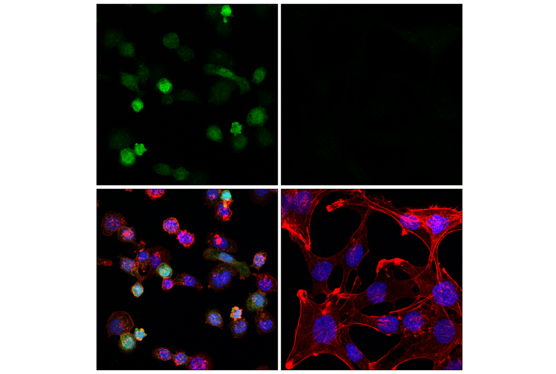 Immunofluorescence Image 1: p47phox (F3Y6C) Rabbit Monoclonal Antibody (BSA and Azide Free)