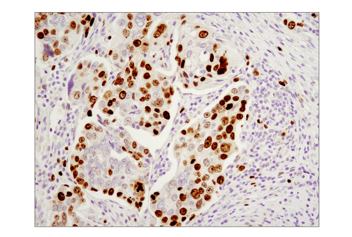 Immunohistochemistry Image 3: Ki-67 (D2H10) Rabbit Monoclonal Antibody