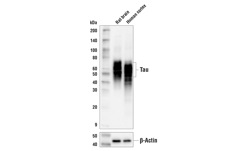 Western Blotting Image 2: Tau (D5D8N) Rabbit Monoclonal Antibody