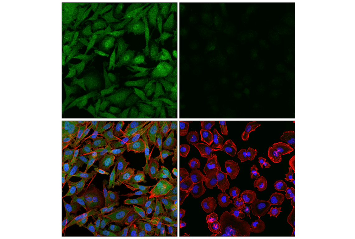 Immunofluorescence Image 1: CRBN (F4I7F) Rabbit mAb