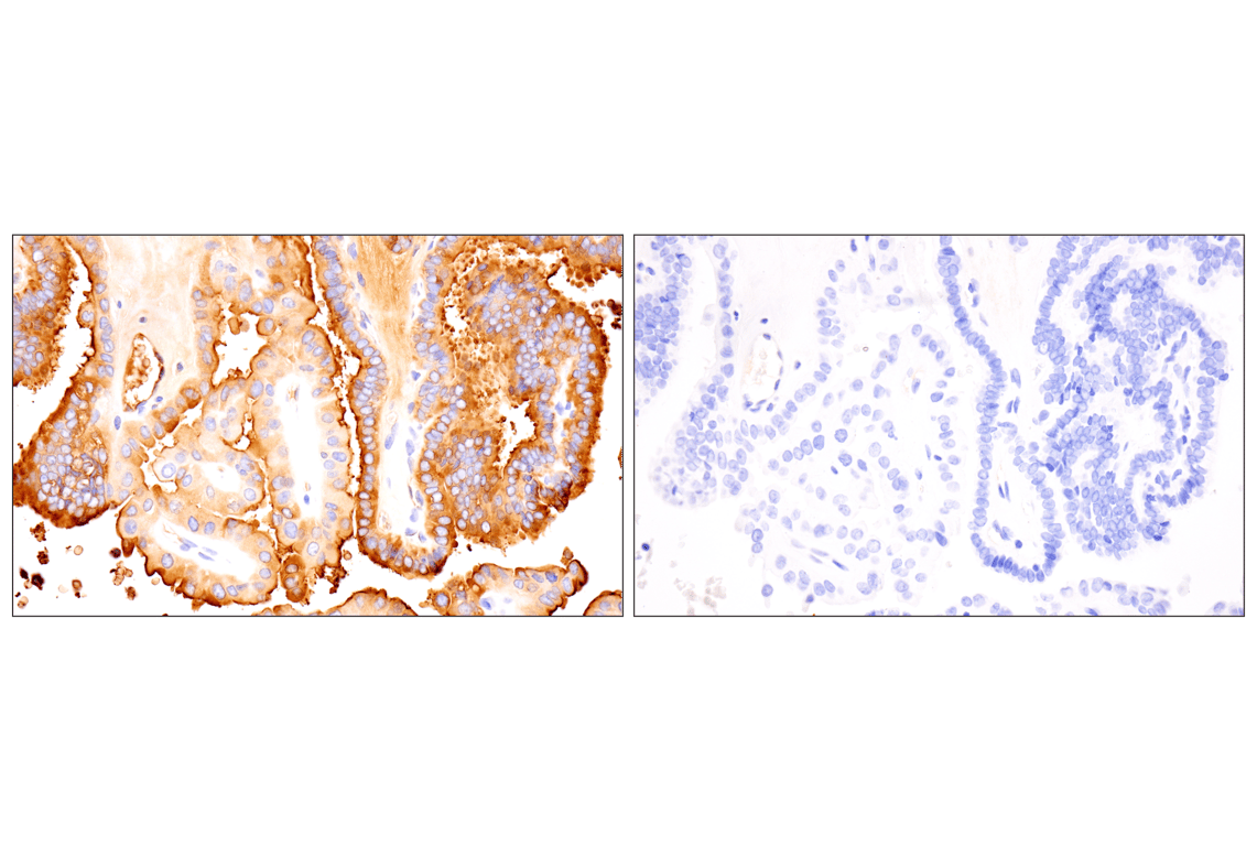 Immunohistochemistry Image 4: Thyroglobulin (F5O9B) Rabbit Monoclonal Antibody
