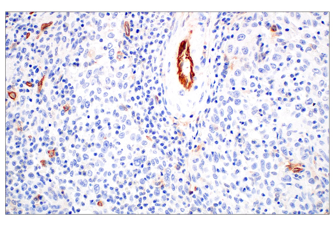 Immunohistochemistry Image 4: CD93/C1qR (E5H9B) Rabbit Monoclonal Antibody
