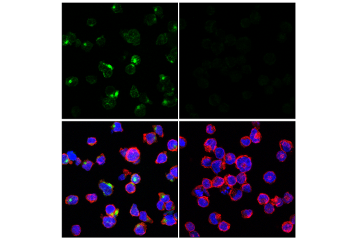 Immunofluorescence Image 1: GNLY (E2T3D) Rabbit Monoclonal Antibody