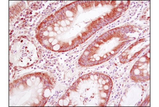 undefined Image 4: PhosphoPlus<sup>®</sup> YB1 (Ser102) Antibody Duet
