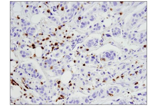 Immunohistochemistry Image 3: CD5 (E8X3S) Rabbit Monoclonal Antibody (BSA and Azide Free)