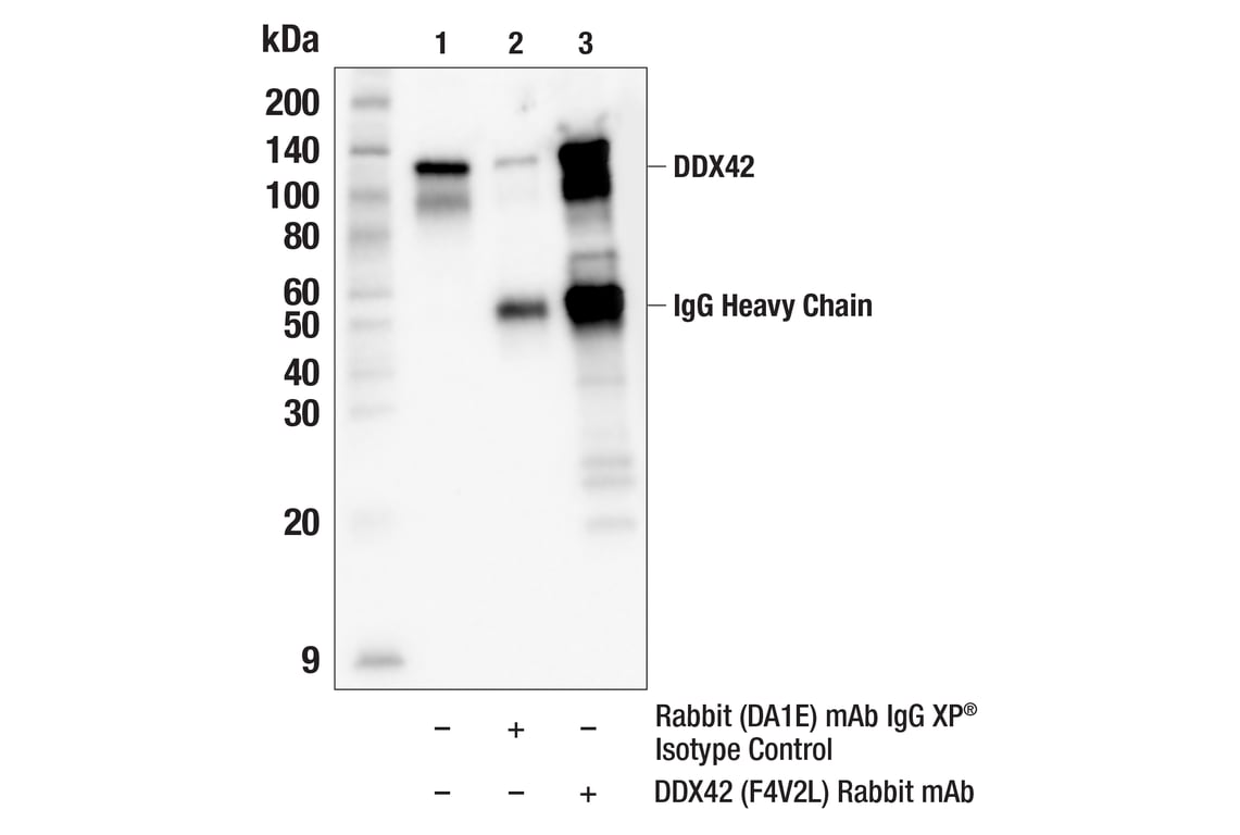 Immunoprecipitation Image 1: DDX42 (F4V2L) Rabbit Monoclonal Antibody