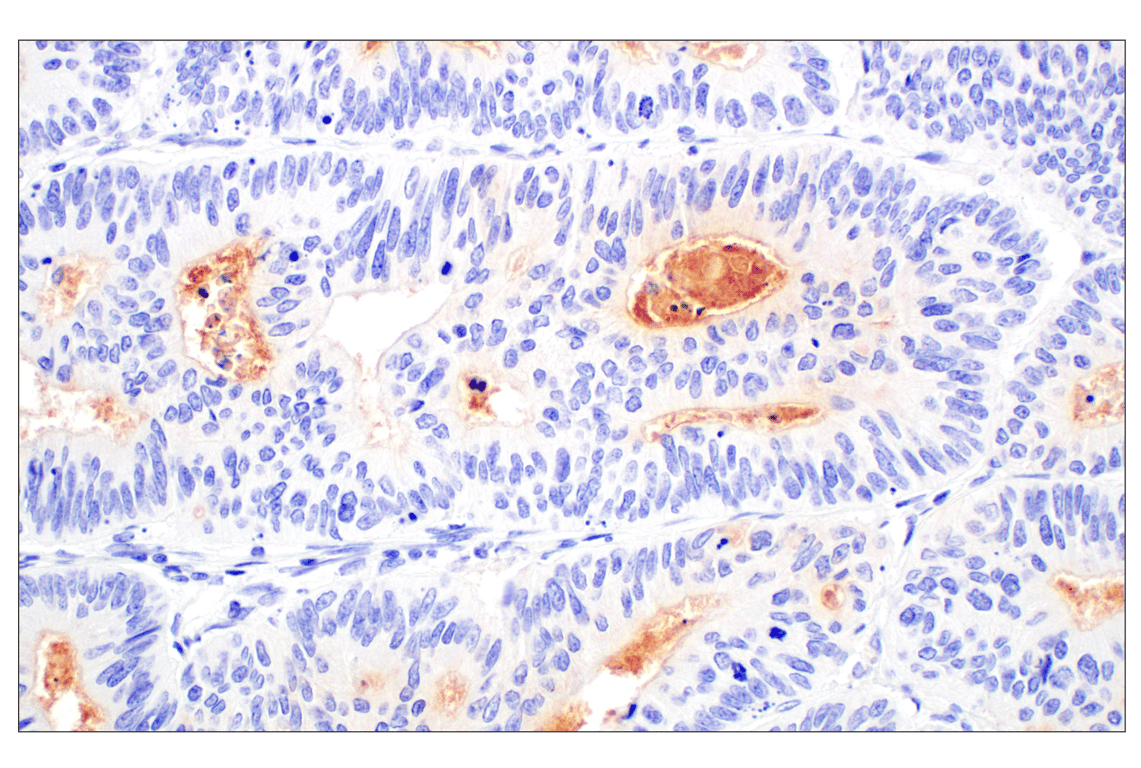 Immunohistochemistry Image 1: Folate Receptor Alpha/FOLR1 (E8U2F) Mouse Monoclonal Antibody (BSA and Azide Free)