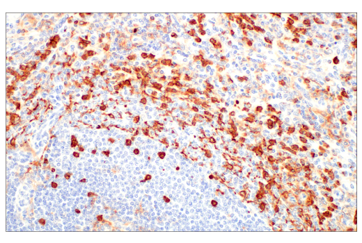 Immunohistochemistry Image 3: CD11b/ITGAM (D6X1N) Rabbit Monoclonal Antibody