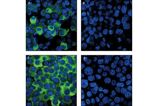 Immunofluorescence Image 1: Phospho-Tyrosine Hydroxylase (Ser40) Antibody