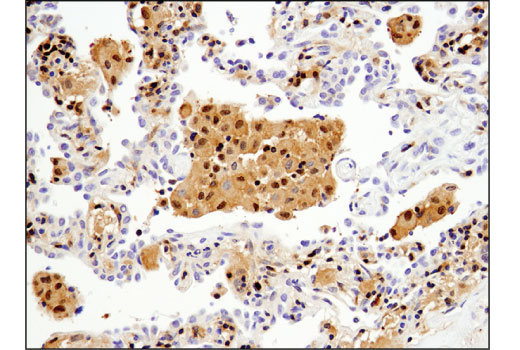 Immunohistochemistry Image 3: Stat5 (D3N2B) Rabbit Monoclonal Antibody
