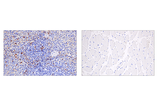 Immunohistochemistry Image 6: Cleaved Gasdermin D (Asp275) (E7H9G) Rabbit Monoclonal Antibody (BSA and Azide Free)