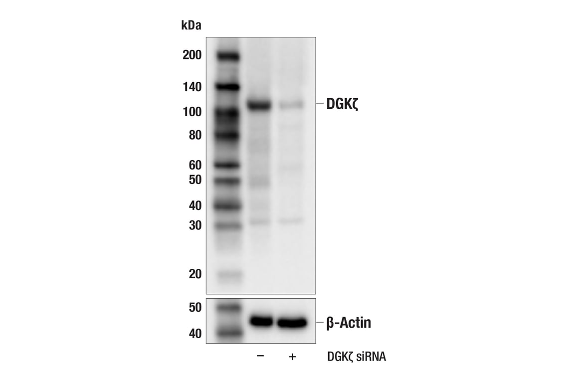 Western Blotting Image 2: DGK zeta (F6W7N) Rabbit Monoclonal Antibody
