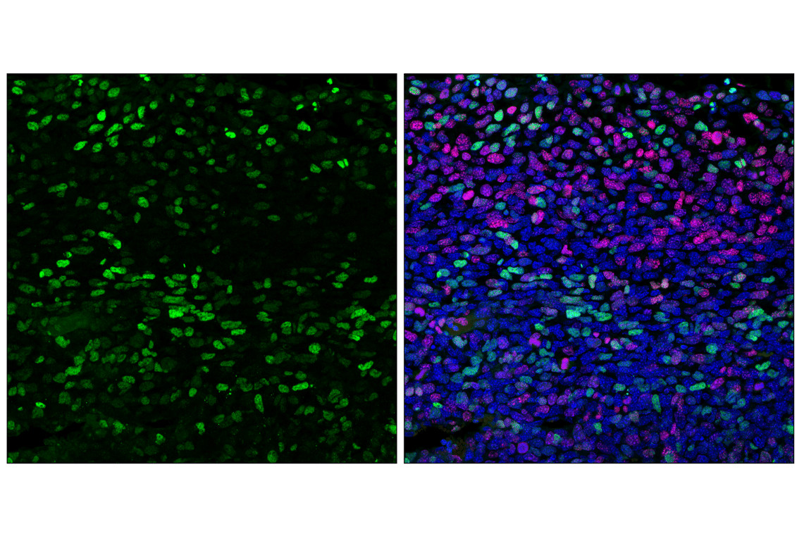 Immunofluorescence Image 3: p21 Waf1/Cip1 (F2C7C) Rabbit Monoclonal Antibody