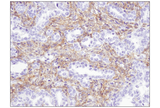 Immunohistochemistry Image 2: STK33 (D3S4R) Rabbit Monoclonal Antibody