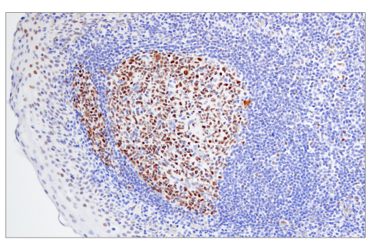 Immunohistochemistry Image 1: BCL6 (E5I8I) Rabbit Monoclonal Antibody (BSA and Azide Free)