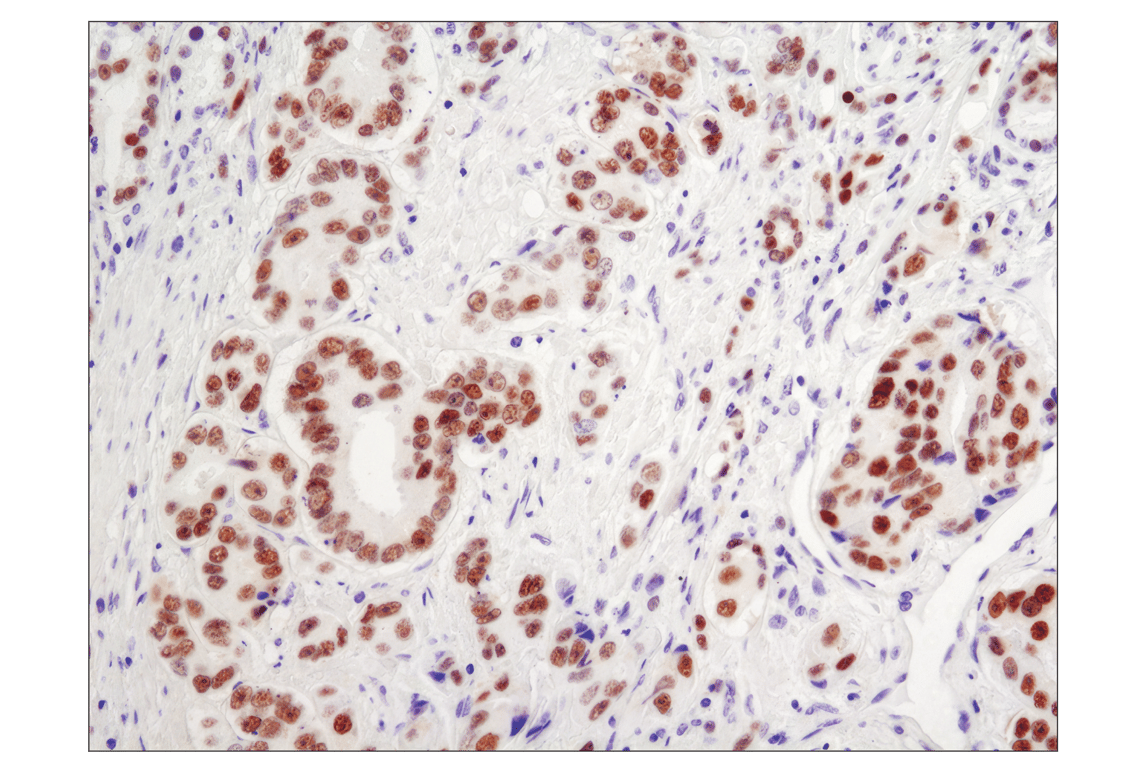 Immunohistochemistry Image 1: Androgen Receptor (D6F11) Rabbit Monoclonal Antibody (BSA and Azide Free)
