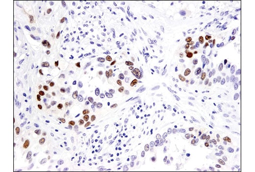 Immunohistochemistry Image 2: Sox9 (D8G8H) Rabbit mAb