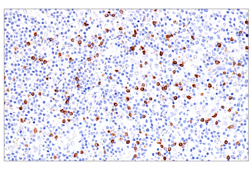 Immunohistochemistry Image 1: GNLY (E2T3D) Rabbit Monoclonal Antibody