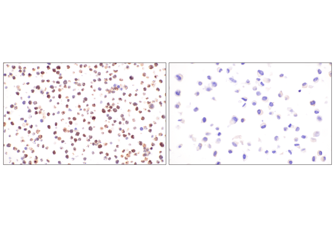 Immunohistochemistry Image 5: p19 ARF (F6F7N) Rabbit Monoclonal Antibody