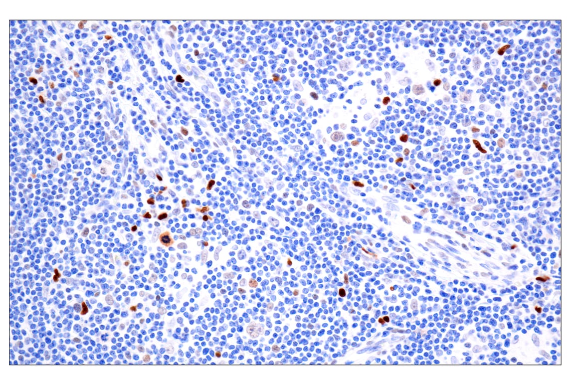 Immunohistochemistry Image 1: BATF3 (E3F3L) Rabbit Monoclonal Antibody