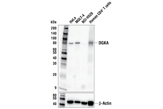 Western Blotting Image 1: DGKA (E2Z7V) Rabbit mAb