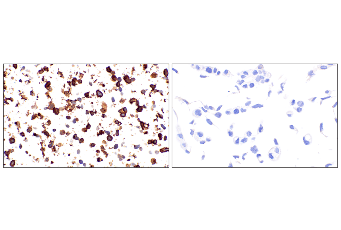 Immunohistochemistry Image 10: GAP43 (E6L2W) Mouse Monoclonal Antibody