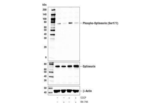 Western Blotting Image 4: Phospho-Optineurin (Ser177) (E8L9I) Rabbit Monoclonal Antibody
