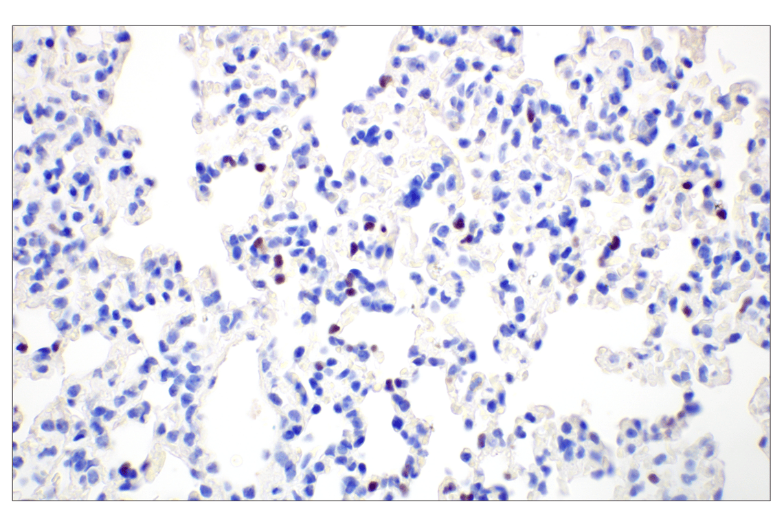 Immunohistochemistry Image 7: T-bet/TBX21 (E4I2K) Rabbit Monoclonal Antibody (BSA and Azide Free)