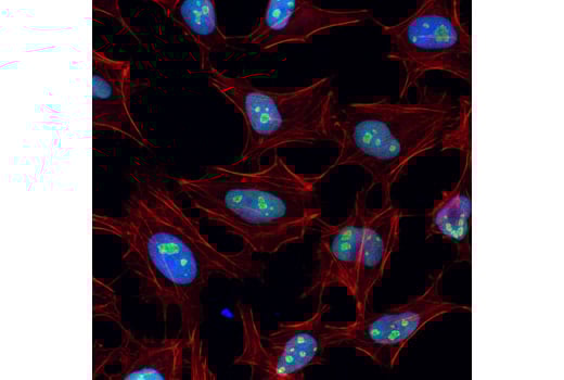 Immunofluorescence Image 1: Nucleolin (D4C7O) Rabbit Monoclonal Antibody