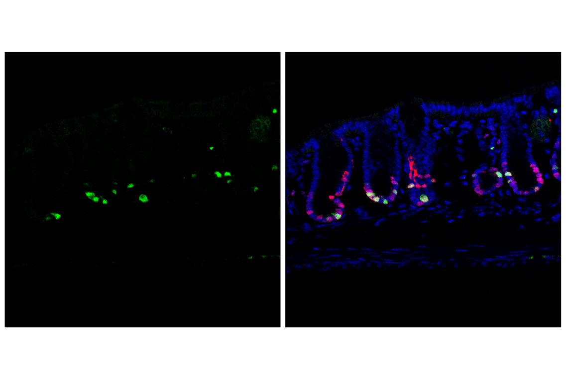 Immunofluorescence Image 2: Cyclin A2 (E9Q5G) Rabbit mAb (BSA and Azide Free)