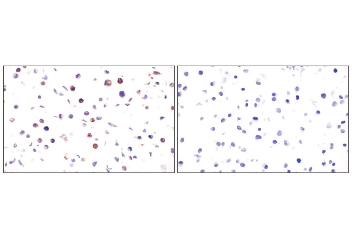 Immunohistochemistry Image 10: Tenascin C (E6N4L) Rabbit mAb