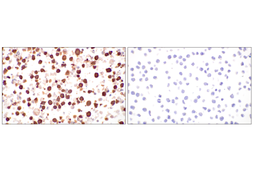 undefined Image 32: Gluconeogenesis Antibody Sampler Kit