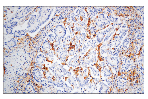 Immunohistochemistry Image 1: CD86 (E2G8P) Rabbit Monoclonal Antibody (BSA and Azide Free)