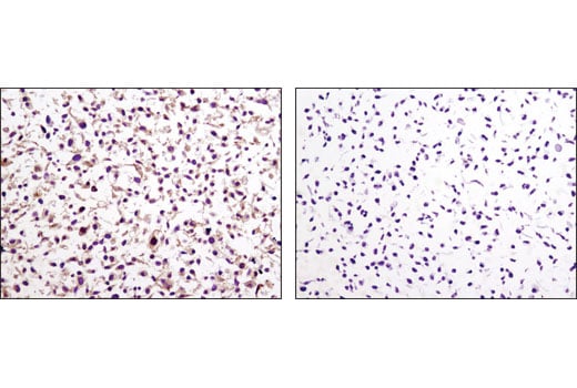 Immunohistochemistry Image 3: LKB1 (D60C5F10) Rabbit Monoclonal Antibody (IHC Formulated)