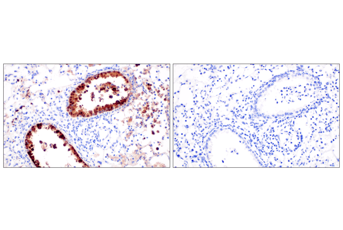 Immunohistochemistry Image 3: Influenza A Nucleoprotein (NP) (F8L6X) Rabbit Monoclonal Antibody