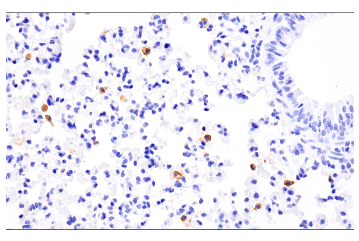 Immunohistochemistry Image 4: PD-L1 (F3Z1T) Rabbit Monoclonal Antibody (BSA and Azide Free)