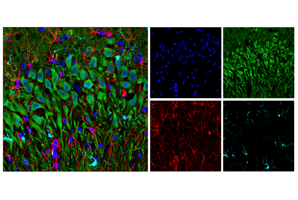Immunofluorescence Image 2: GFAP (E8S7G) Mouse Monoclonal Antibody